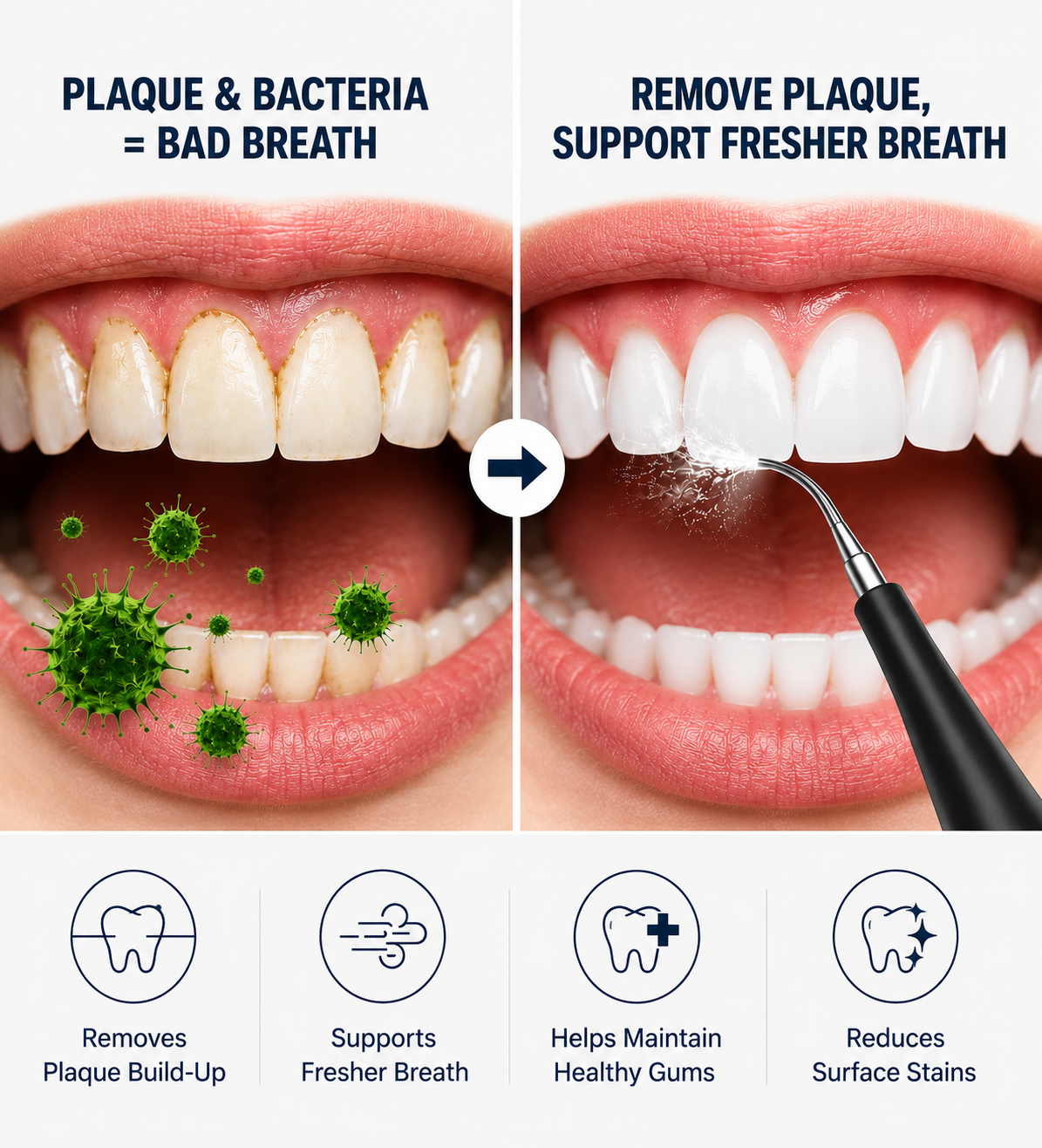 SmellFresh™ Ultrasonic Plaque Remover